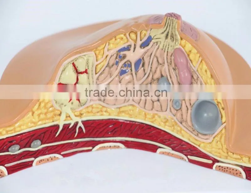 Medical breast disease model breast anatomical model medical training model breast feeding model