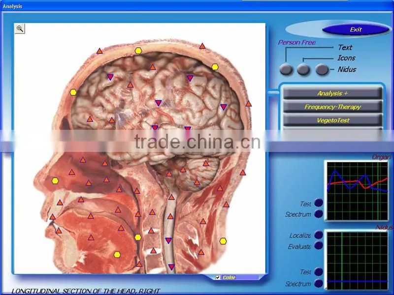 2016 hot 3d nls quantum health test machine with English and Spanish