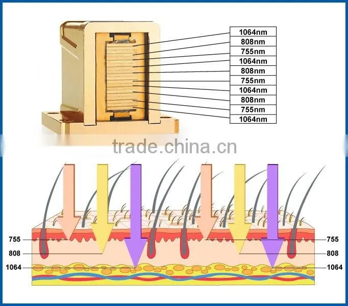 KM300D Professional portable painless depilation 808 diode laser hair removal / 808 diode laser hair removal equipment / machine