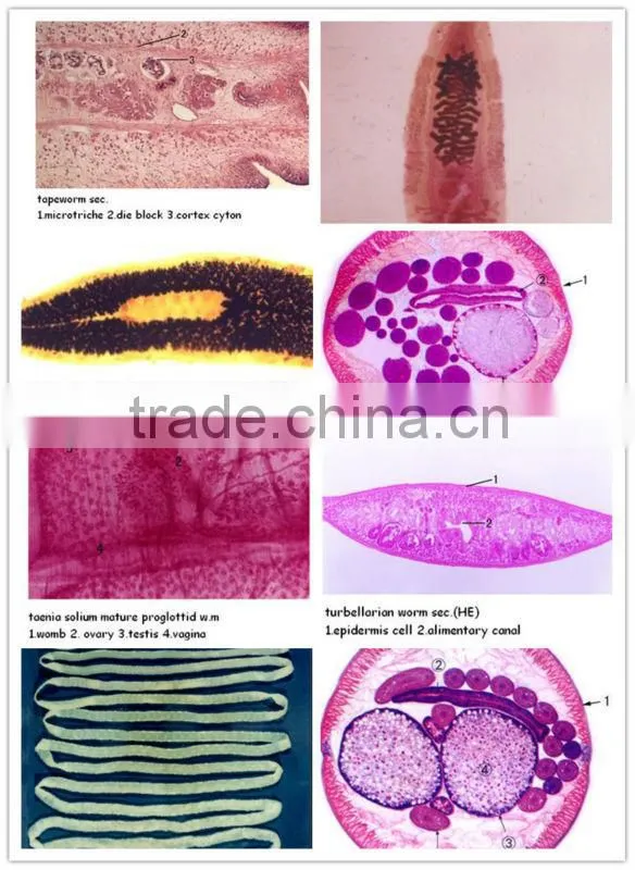 medical parasitological prepard slides amoeba section set microscope parasite