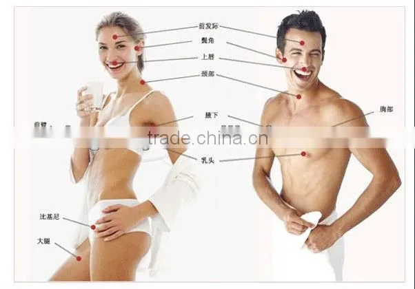 TM-J116 hot sale black doll nd-yag laser