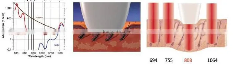 pain free laser hair removal/diode laser 808 nm salon machine