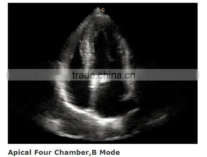 Laptop Color Doppler Ultrasound Price & portable color doppler ultrasound machine