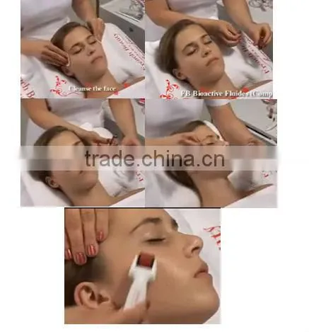 A BIG discount for closing Christmas /microneedle dermal roller/derma roller for hair loss treatment
