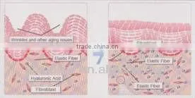 Red LED Mask for skin rejuvenation