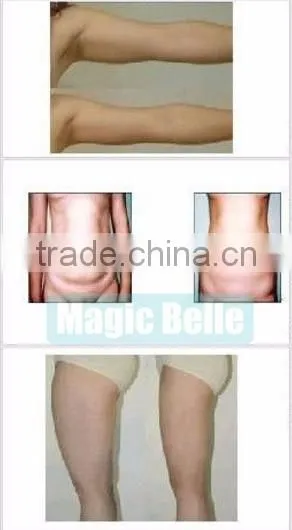 Air Pressure/Far Infrared/Pressotherapy Machine for Home Use
