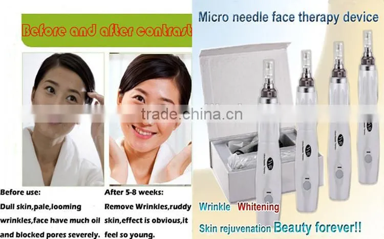 Best microneedle machine fractional rf microneedle