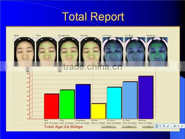 2016 Hot-sell Professional magic mirror skin analyzer,skin center/hospital use BD-P027