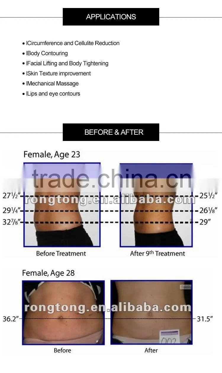body Slimming Spa Equipment MED-360