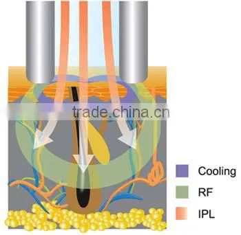 multifunctional e light ipl rf beauty equipment