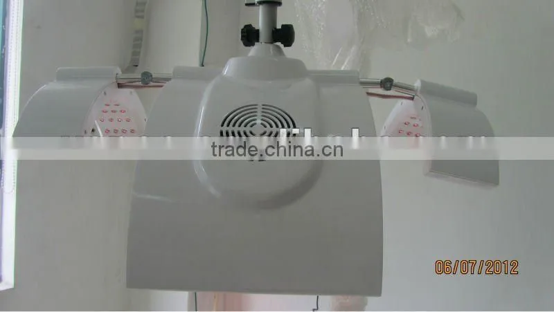 hair loss solution laser