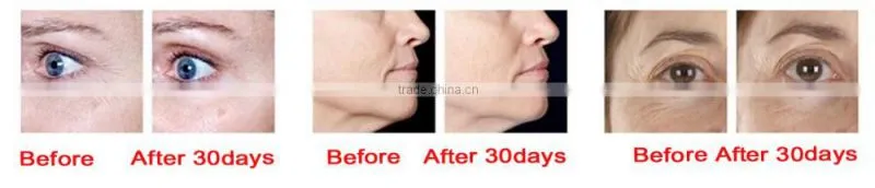 Red light anti ageing Heat skin rejuvenation beauty device
