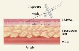 Hottest ,Newest co2 carboxytherapy machine for face wrinkle remover