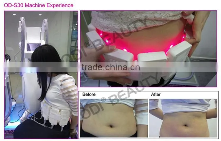 OD-S30 BV Approved Intelligent fat reducing slimming smart lipo laser
