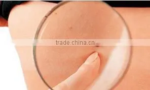 liquid co2 laser plasma pen for spots freckle mole removal