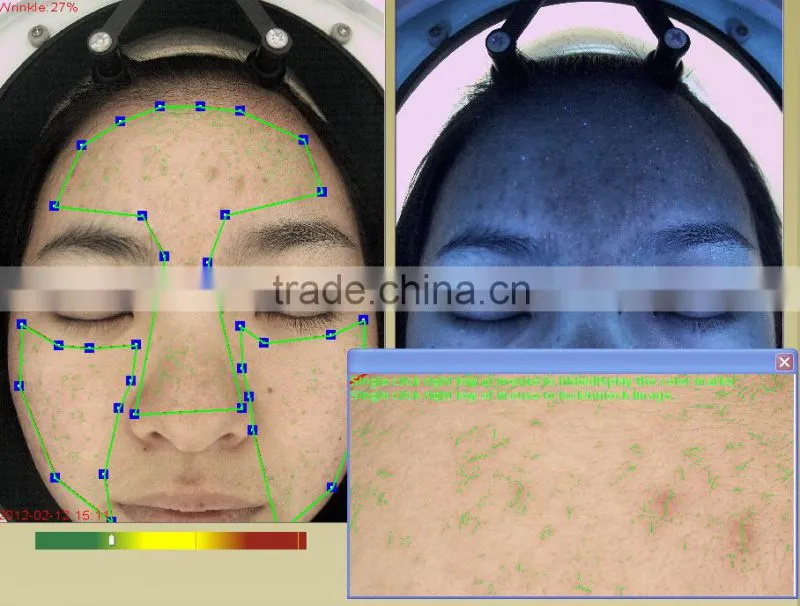 skin analyzer magnifier machine skin analysis system