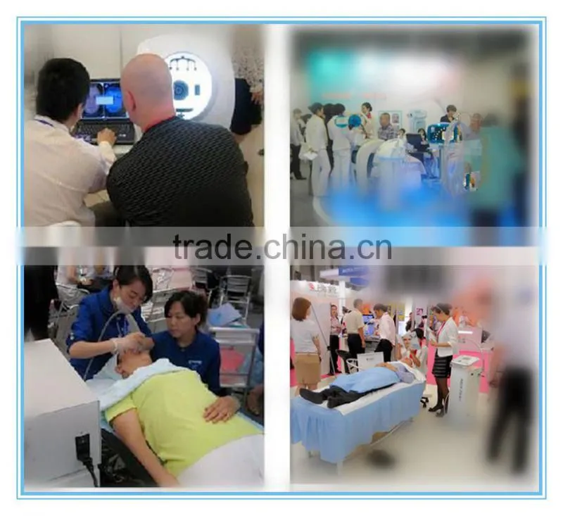 lightsheer laser hair removal machine for sale