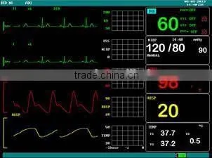 F5 Multi-parameter Monitor