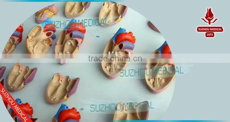 Effects of hypertension, 5 parts