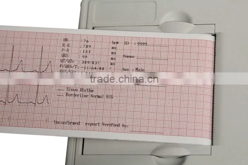 Cheap ecg machine / Price of ecg machine EKG-903A2/ ECG