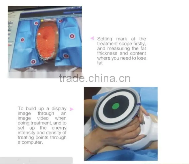 Ultrashape new slimming technology machine cavitation slimming machine