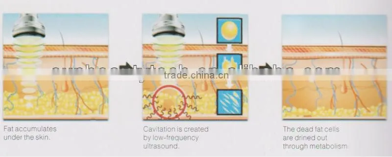 Mini Cavitation Machine for body slimming