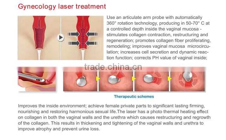Professional 2017 newest 1-100ms pulse duration 30w fractional co2 laser treatment for acne scars