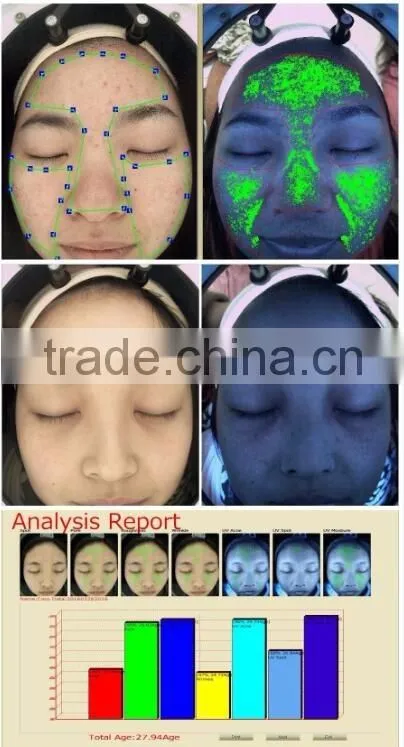 ORIGINAL!!! LANGDI Magic Mirror Skin Analyzer / Skin Analysis Machine with CE