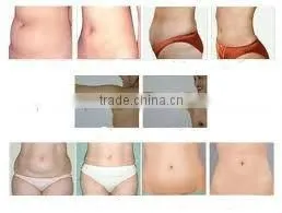 F019 Portable RF slimming machine with Vacuum head