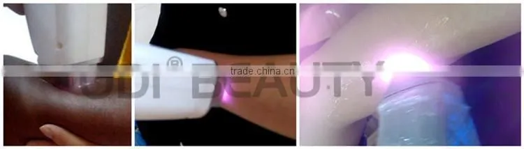 Wholsale 808nm Diode Laser hair removal machines OD-LS808