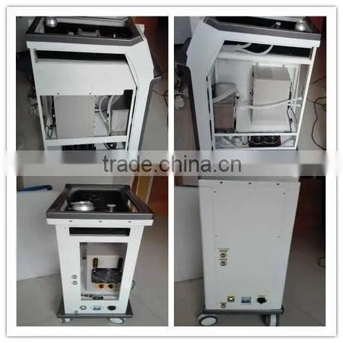 Alibaba in spanish wholesale tattoo removal yag laser q switched nd yag laser/tattoo aesthetic laser