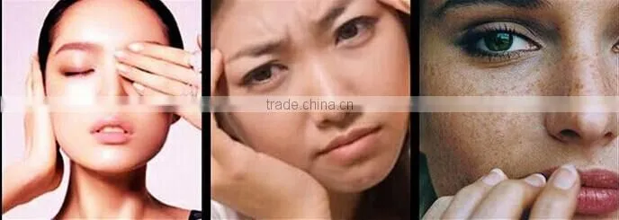 Best Lemon Papaya Whitening and Freckle Spots Remove Cream Aichun Freckle Removing Cream