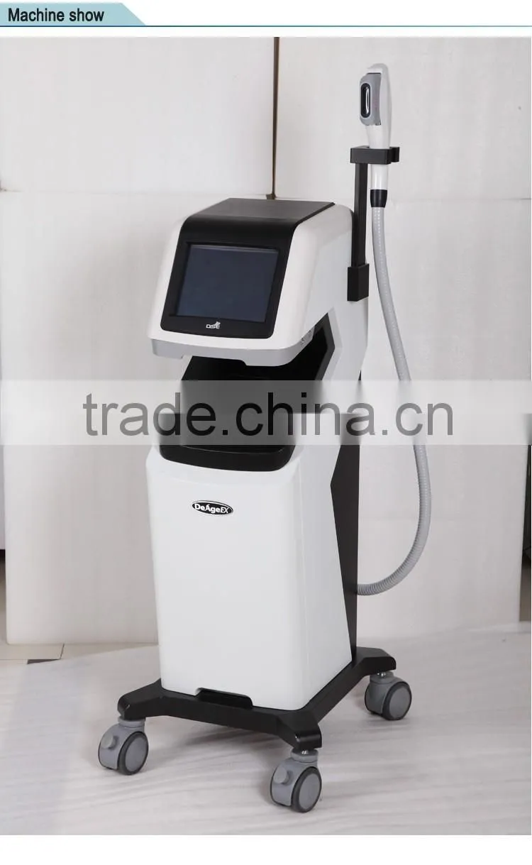2016 best machine/ high intensity focus ultrasound/ face lift