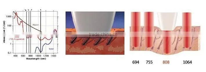 Hot sale portable 808nm diode laser hair removal machine/the best price