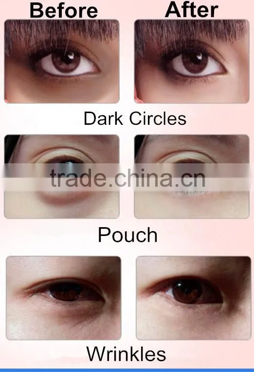hot in 2016 factory price eye beauty popular vibration eye max massager