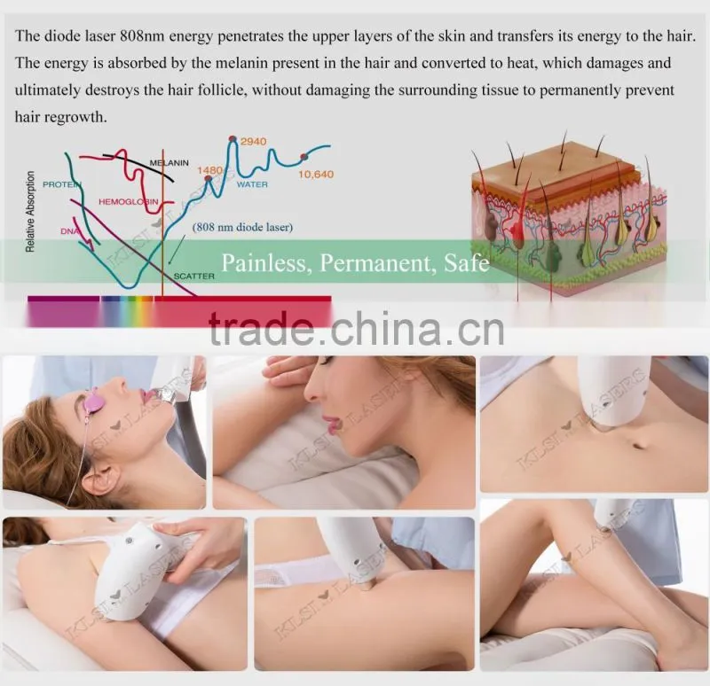 Germany bars Italy pump portable Hot sale 808 diode laser hair removal equipment/laser diodo