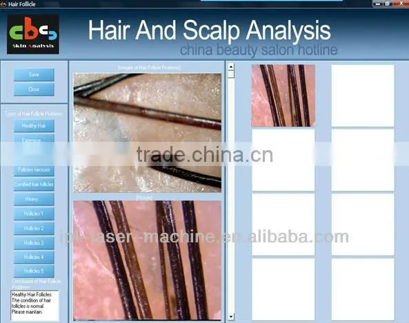 High definition hair analyzer mcahine