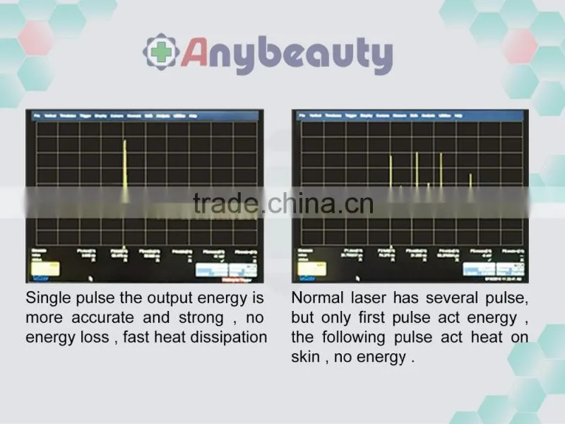 Anybeauty 808nm diode laser hair removal machine for dark skin