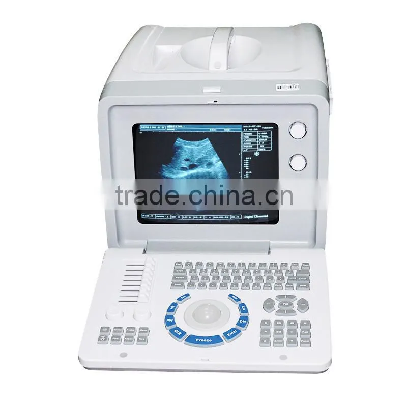 Low cheap portable Ultrasound Scanner 10 inch optional video thermal recorder