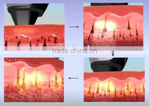 Guangzhou HETA Skin care cavitation RF vacuum Beauty salon Equipment