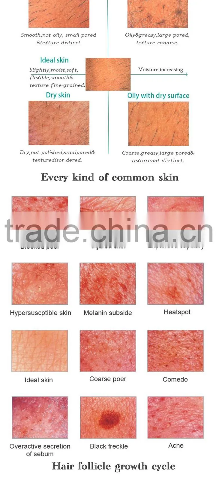 Portable Skin Hair Test Analyzer