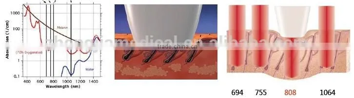 portable hair removal ipl/shr laser machine/elight laser 3 in 1 multifunctional machine