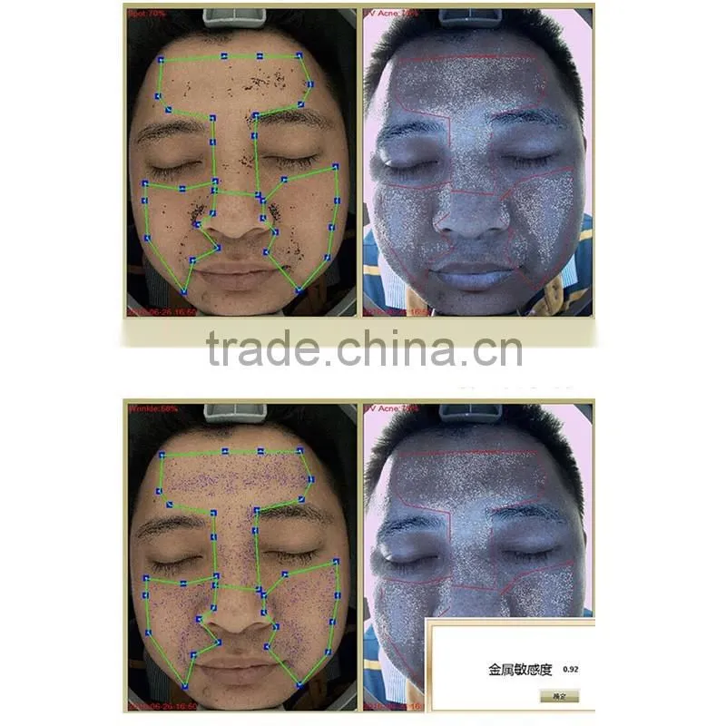 2016 most effective facial reveal imager skin analysis/skin analysis camera