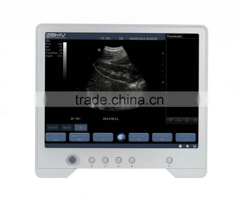 B&W touch screen ultrasound scanner/machine TS20