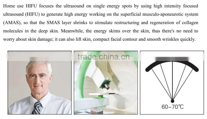 face lifting china beauty spa equipment / hifu beauty salon equipment
