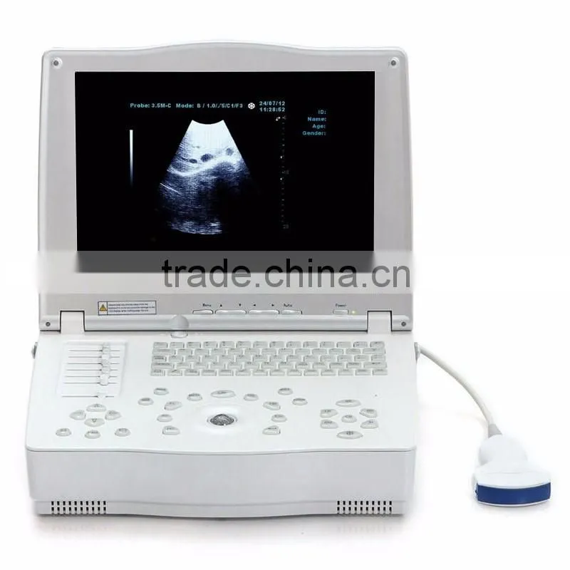 CE&ISO13485&FDA approved digital portable type 15-inch Laptop Ultrasound Scanner