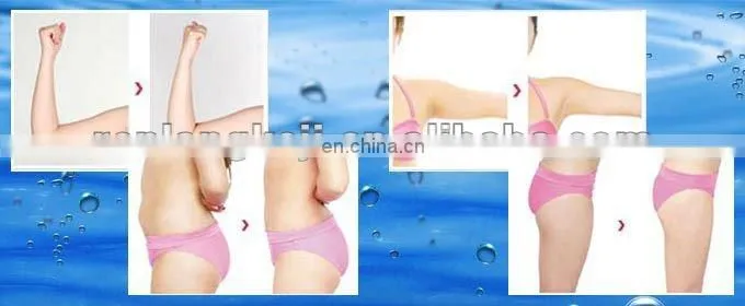 Try it and you will like it! RL-I01! lipo cavitation and radio frequency machine