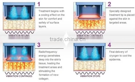 2015 Hot New Fractional RF Micro Needle Facial Machine/ Home Infrared Skin Tightening Machine