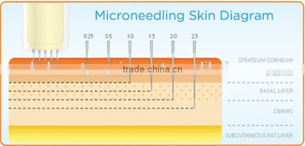 china low price products derma pen mts
