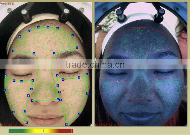 Professional Skin Analyzer Machine/skin analyser/skin test